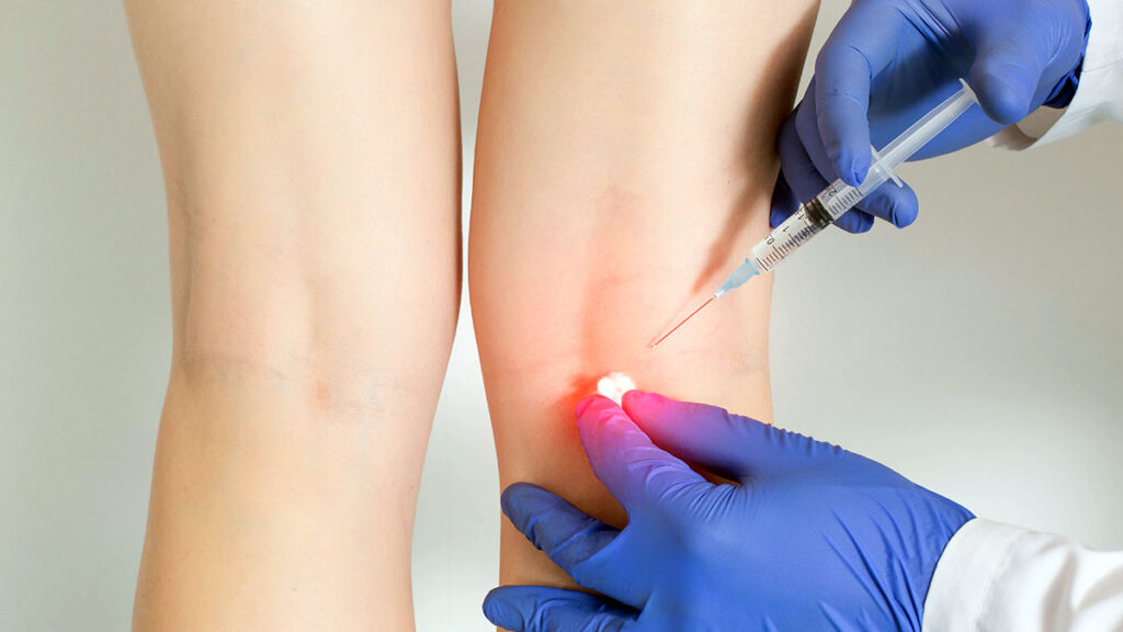Genicular Injection Mmb Geniculate Nerve Block Procedure NJ – Allied Neurology Interventional ...