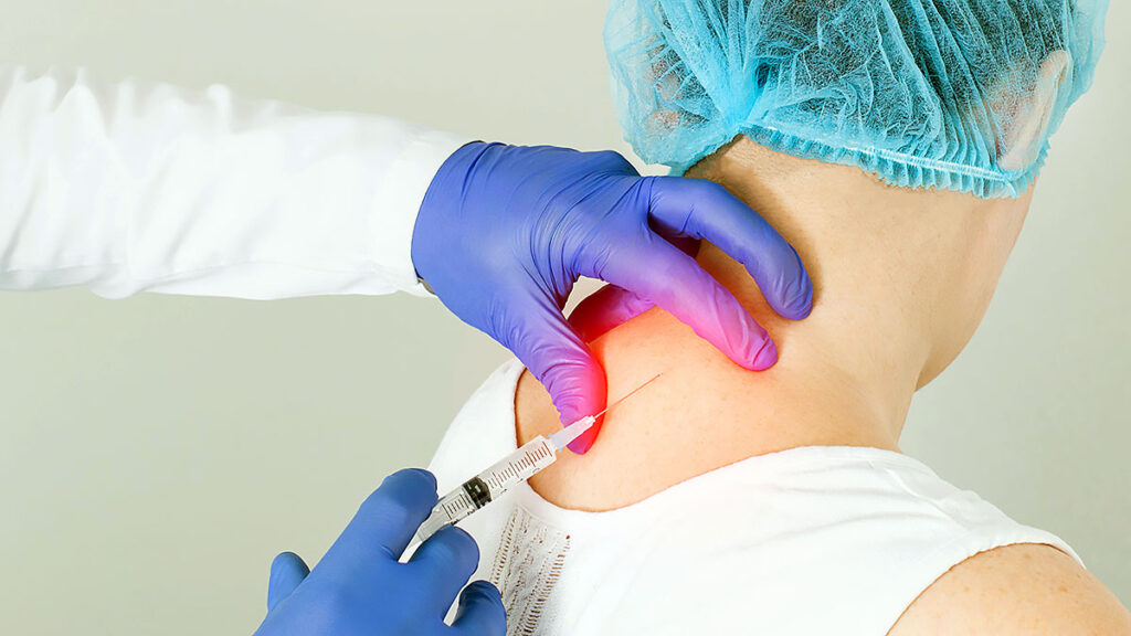 Medial Injection Lumbar Medial Branch Block Injection NJ – Allied Neurology ...