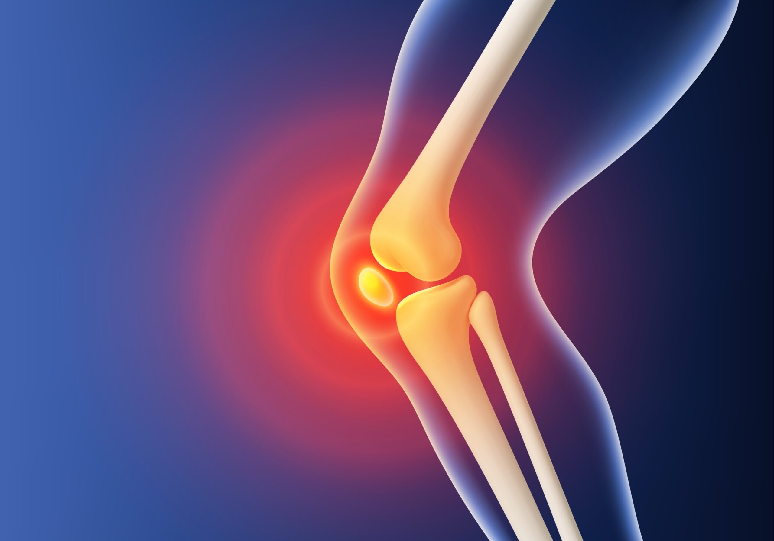 knee pain what to do