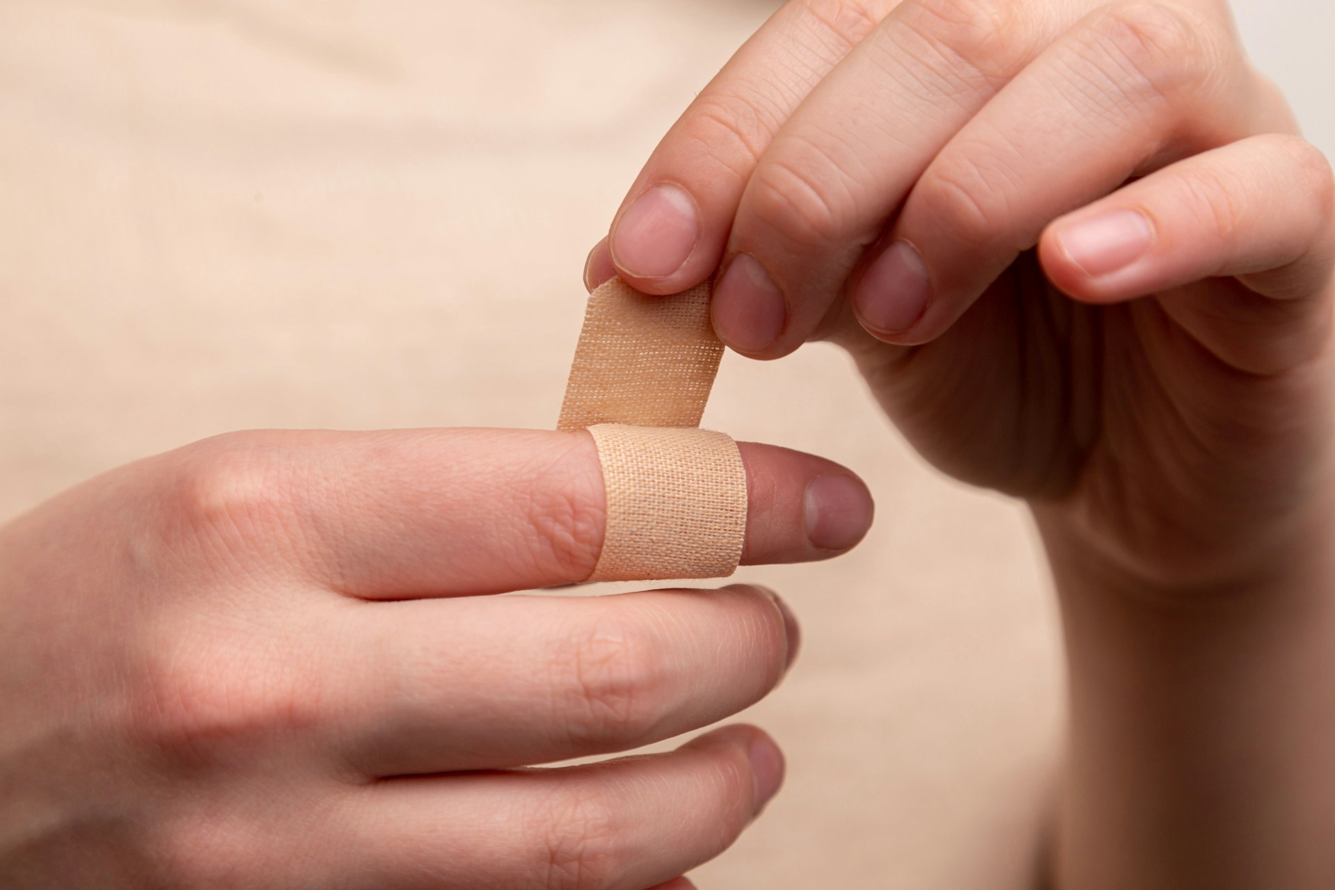 prp treatment